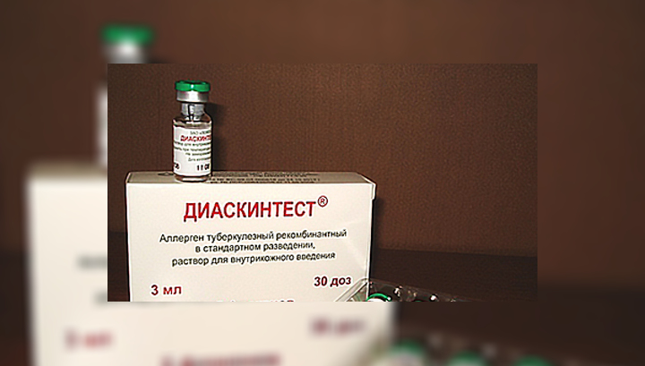 Как сделать диаскинтест в поликлинике Как сделать диаскинтест в поликлинике
