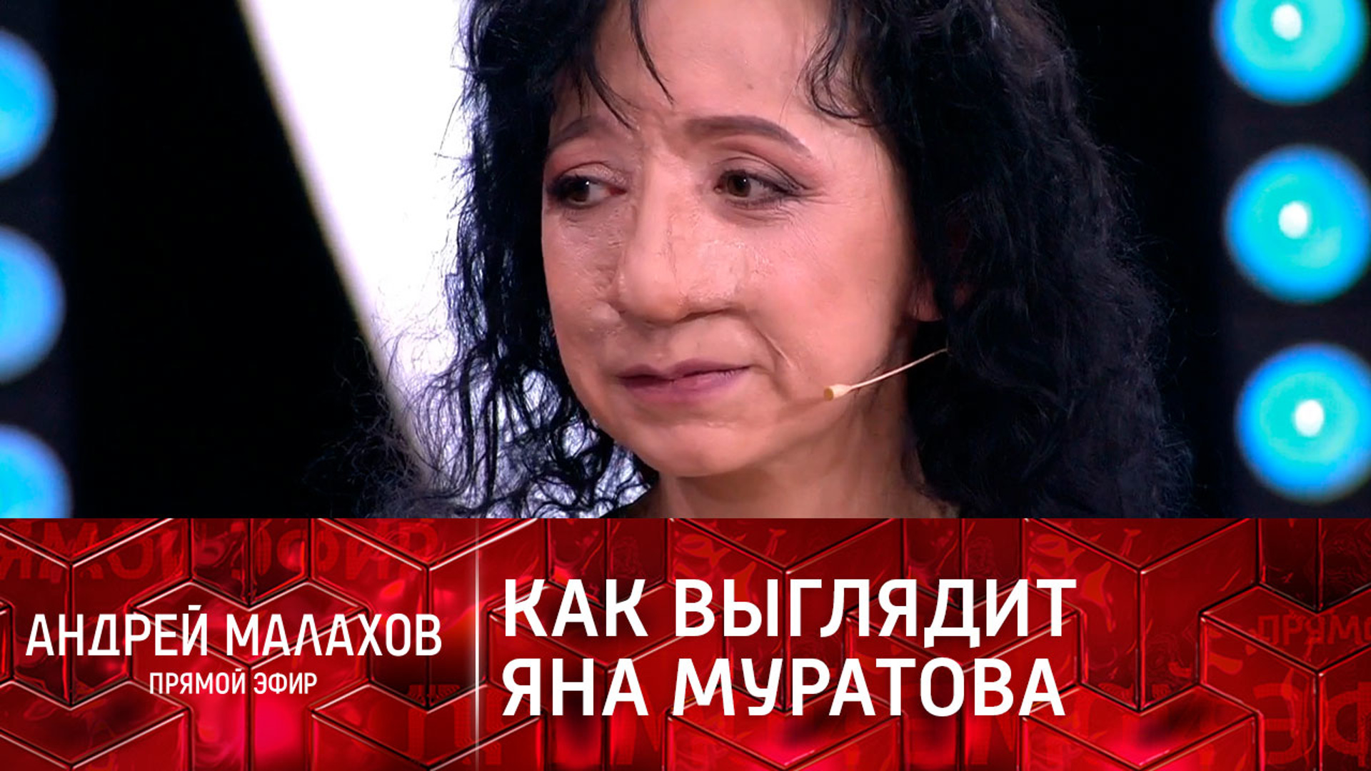 Яна муратова до и после операции