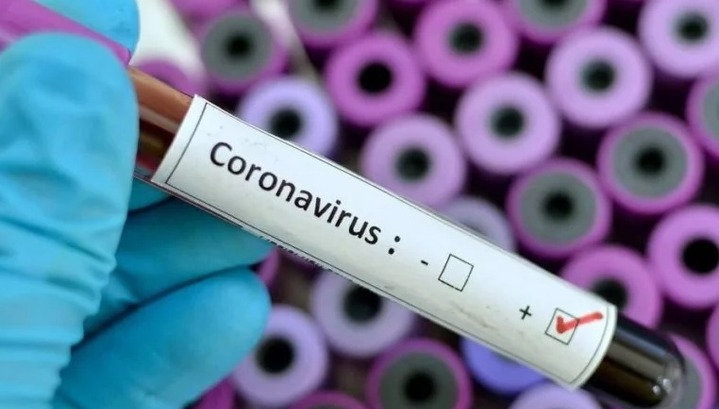 Тест-системы на коронавирус доставили в Челябинск