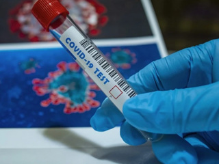 В Самарской области 43 человека заболели коронавирусом