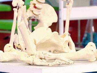 Остеопороз: что важно знать о болезни хрупких костей