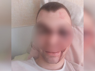 Зверски избитый мужчина отказался от госпитализации, заверяет Минздрав
