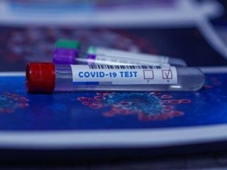 Результаты тестов на коронавирус новгородцам будут присылать на телефон