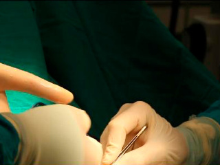 Тюменские врачи провели уникальную операцию по пересадке печени