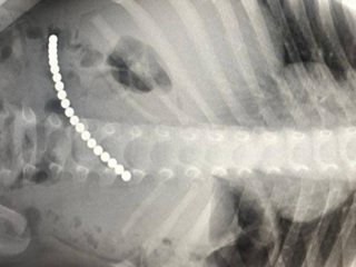 Ребенка с 20 магнитными шариками в животе прооперировали в Подмосковье