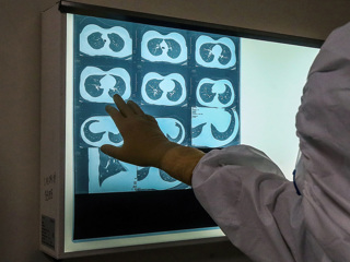 Отечественная нейросеть выявляет ковид по рентгеновским снимкам