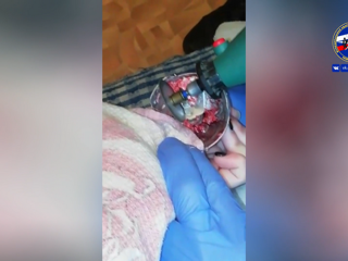 Палец в блендере: новосибирские спасатели помогли 18-летней  девушке