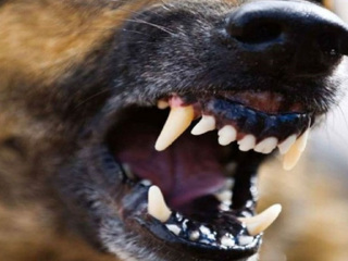 Бойцовская собака держит в страхе вологодских жителей