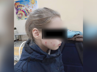 В Уфе избили 10-летнюю девочку за то, что она кормила кошек