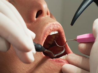 В Иркутске орудует ортодонт, портящий зубы пациентам
