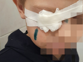 В Сызрани школьник едва не лишился глаза из-за халатности коммунальщиков