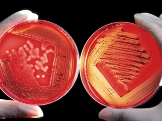 В кишечнике нашли бактерии, влияющие на накопление токсинов в крови