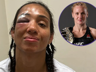 Чемпионка UFC Шевченко сломала сопернице лицевую кость