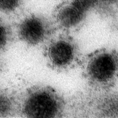 Британские вирусологи сообщили о появлении нового штамма коронавируса