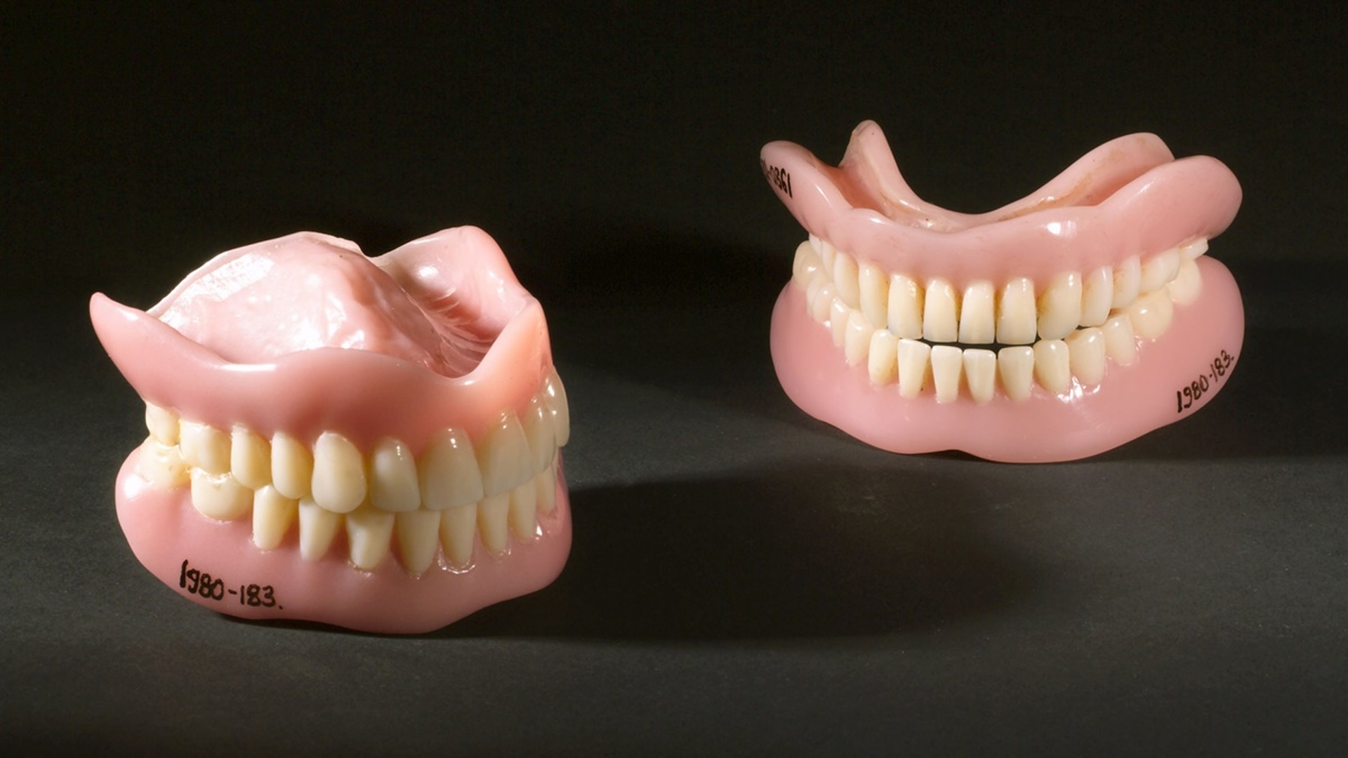 Протезирование зубов в казани. Вставная челюсть.