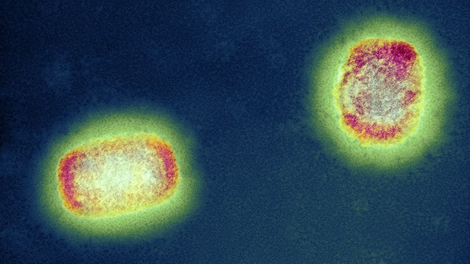 Вирус оспы под микроскопом