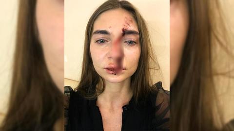 Новосибирскую певицу избили в московском салоне красоты