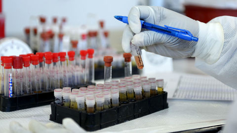 Простой анализ крови выявит белок, указывающий на деменцию
