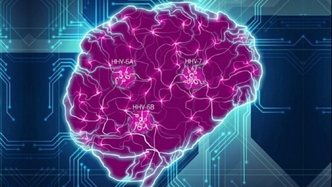 На новый лад: вирус герпеса связан с развитием болезни Альцгеймера