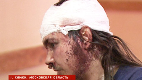 Полиция квалифицирует нападение на химкинского эколога как грабеж