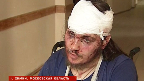 СК запросил материалы о нападении на защитника Химкинского леса