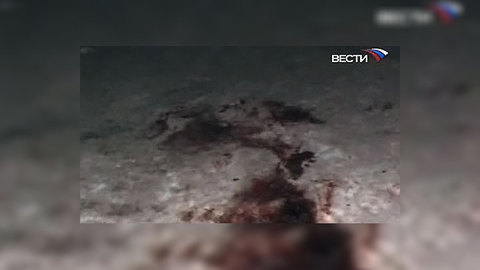 В Орле подростку оторвало кисть руки петардой
