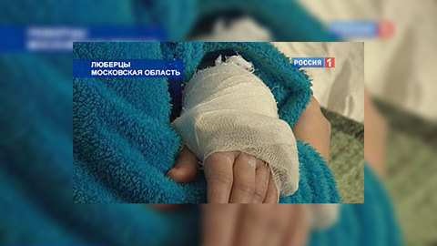 Петарды и гололёд уложили в больницы десятки москвичей