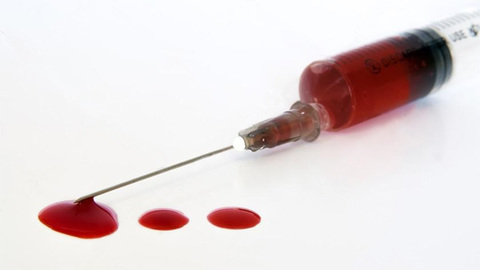 DBS в помощь WADA: грядет революция в методах определения допинга