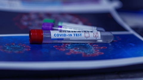 Фонд XPrize заплатит $5 миллионов за лучший тест на COVID-19