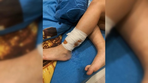 Стая бродячих собак покусала мальчика на глазах у беременной мамы