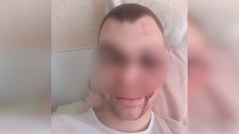 Зверски избитый мужчина отказался от госпитализации, заверяет Минздрав