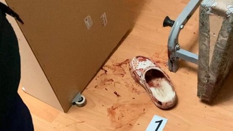 Бытовой конфликт в Обнинске закончился убийством