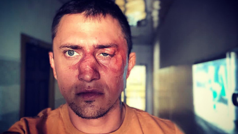 Избивший Прилучного бизнесмен впервые рассказал свою версию конфликта