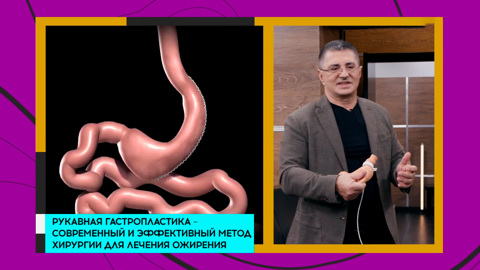 Александр Мясников объяснил, кому показано ушивание желудка