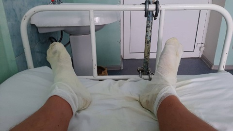 Житель Ярославской области обварил ноги из-за прорыва трубы
