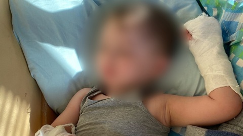 Ребенок лишился части пальца на руке в нижегородском детсаду