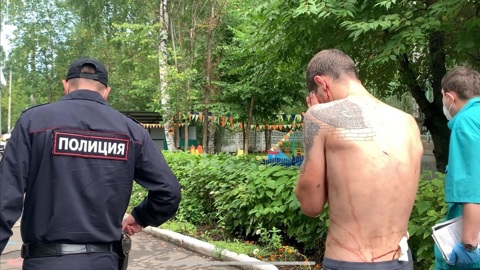 Разбил стекло: в Иванове полуголый мужчина проник на территорию детского сада