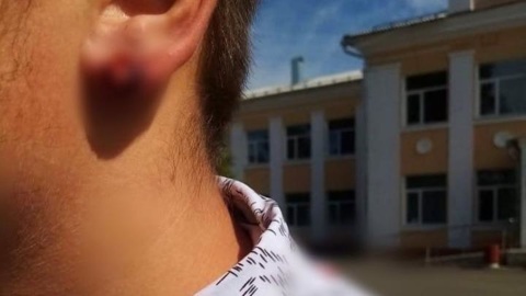 Конфликт директора школы и ученика из-за сережки вышел из-под контроля