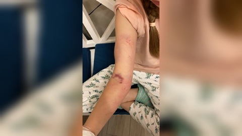 "Протащил по асфальту": в Ярославле девочку зажало дверьми автобуса