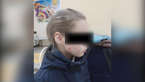 В Уфе избили 10-летнюю девочку за то, что она кормила кошек