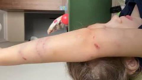 В Сургуте прохожая спасла 8-летнюю девочку от стаи бездомных собак