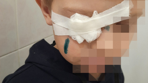 В Сызрани школьник едва не лишился глаза из-за халатности коммунальщиков