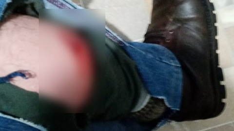 Свора собак напала на мужчину в Якутске