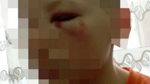 В Новосибирске ищут мужчину, избившего подростка