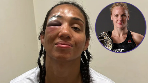 Чемпионка UFC Шевченко сломала сопернице лицевую кость