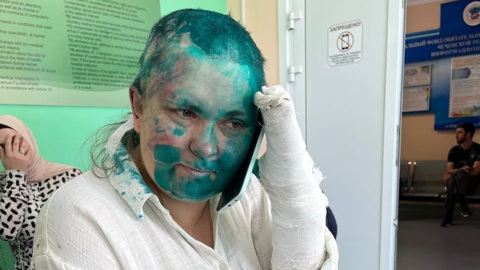 Пострадавшую в Чечне журналистку выписали из больницы