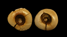 Пещерная стоматология: самая древняя зубная пломба была поставлена 13 тысяч лет назад