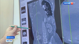 В Краснодаре женщине удалили 4-киллограмовую опухоль, о которой она не знала