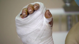 В Красногорске врачи смогли пришить мужчине отрезанную пилой руку