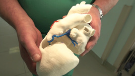 3D-сердце: у хирургов появился тренажер